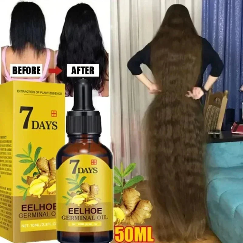 7-Day Rapid Growth Ginger Hair Serum – Anti-Hair Loss & Scalp Nourishing Treatment